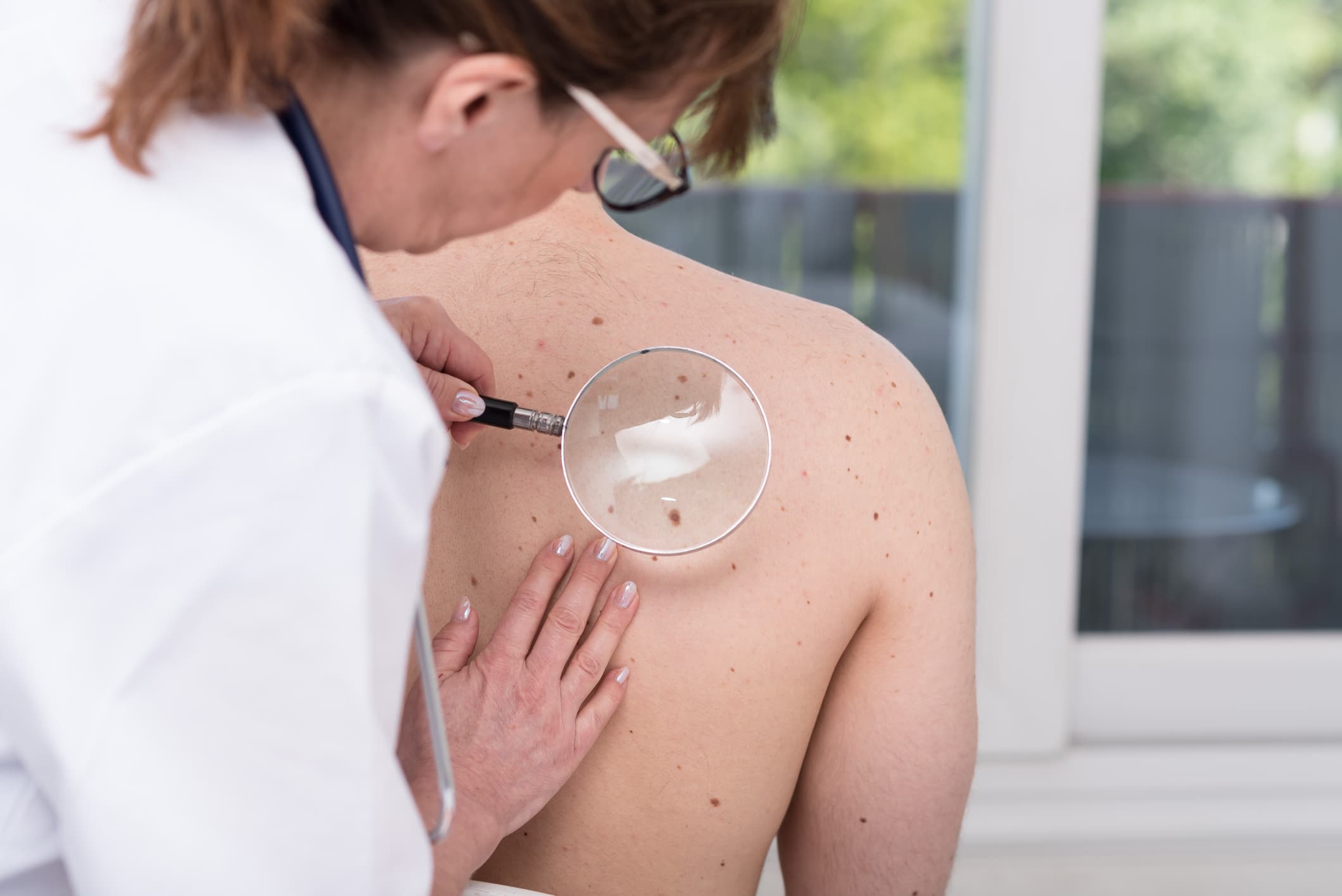 Empowering Melanoma Risk Assessment