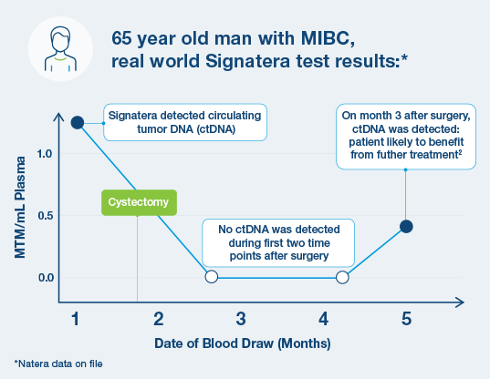 Bladder Cancer Graph