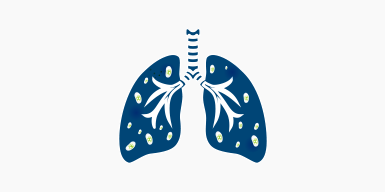 wh-hor-3col-385z192_clinician_cystic-fibrosis Cystic fibrosis